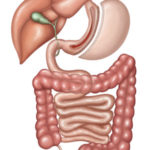 Gastro Inclusive - Gastrectomia Vertical (Sleeve Gástrico)